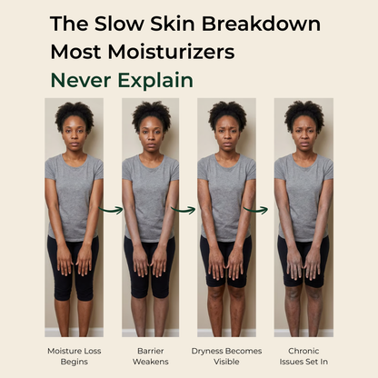 Pure Nilotica Shea Butter by ACROM™