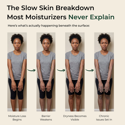 Pure Nilotica Shea Butter by ACROM™ Single