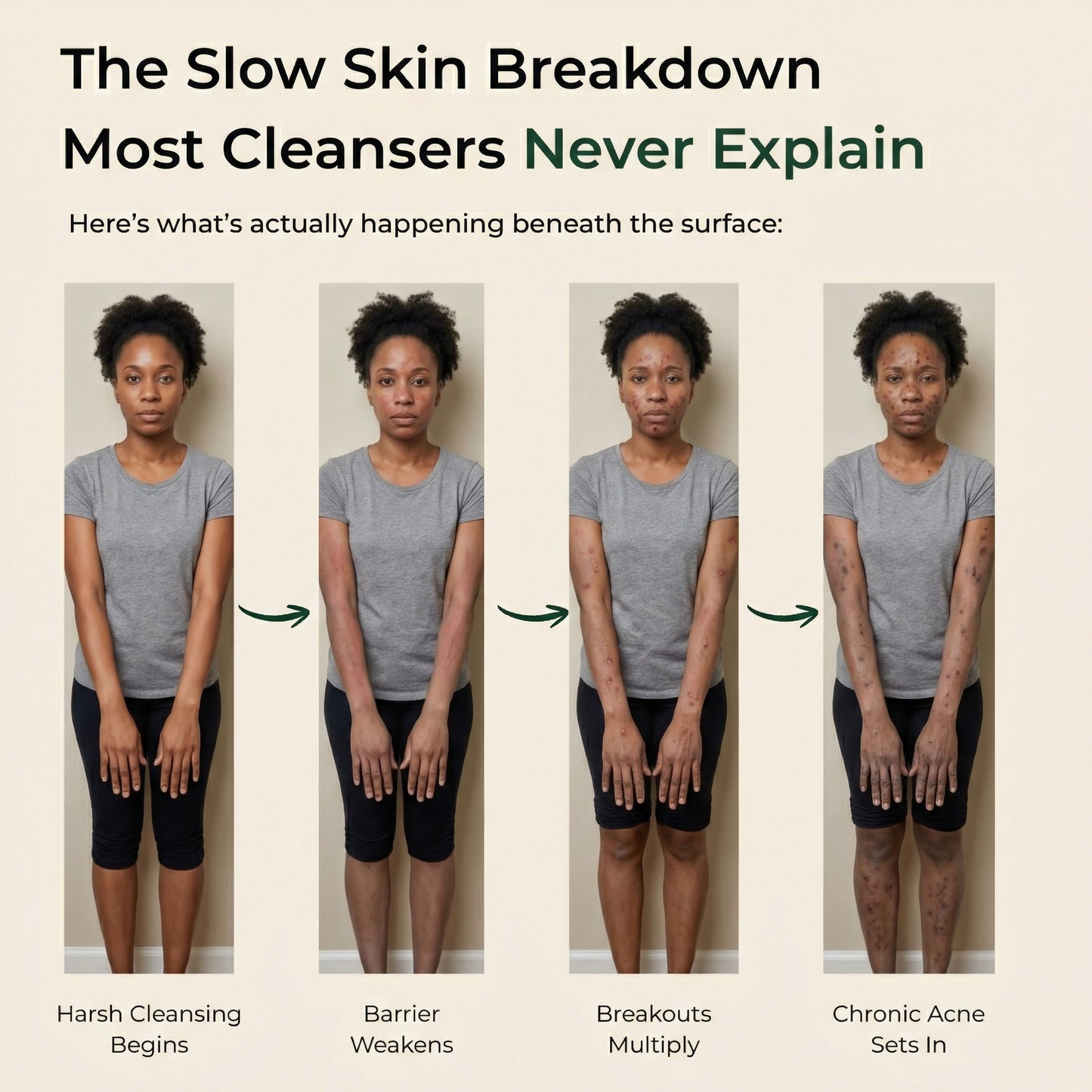 Pure African Black Soap by ACROM™