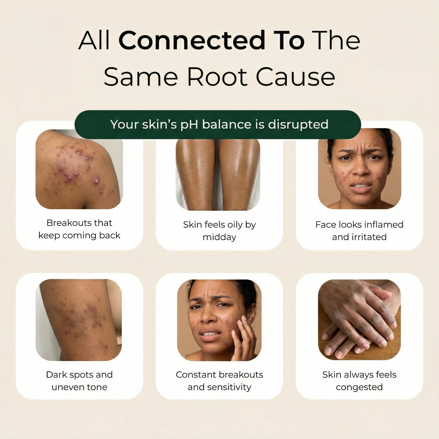 Pure African Black Soap by ACROM™