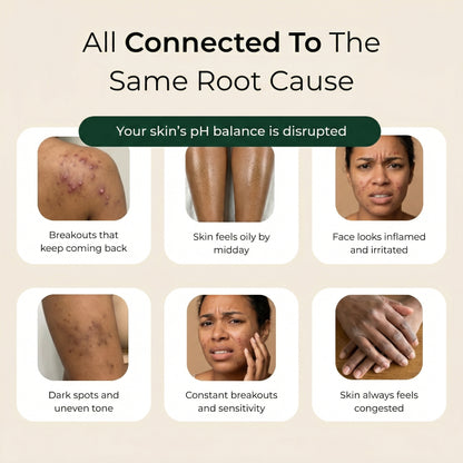 Pure African Black Soap by ACROM™